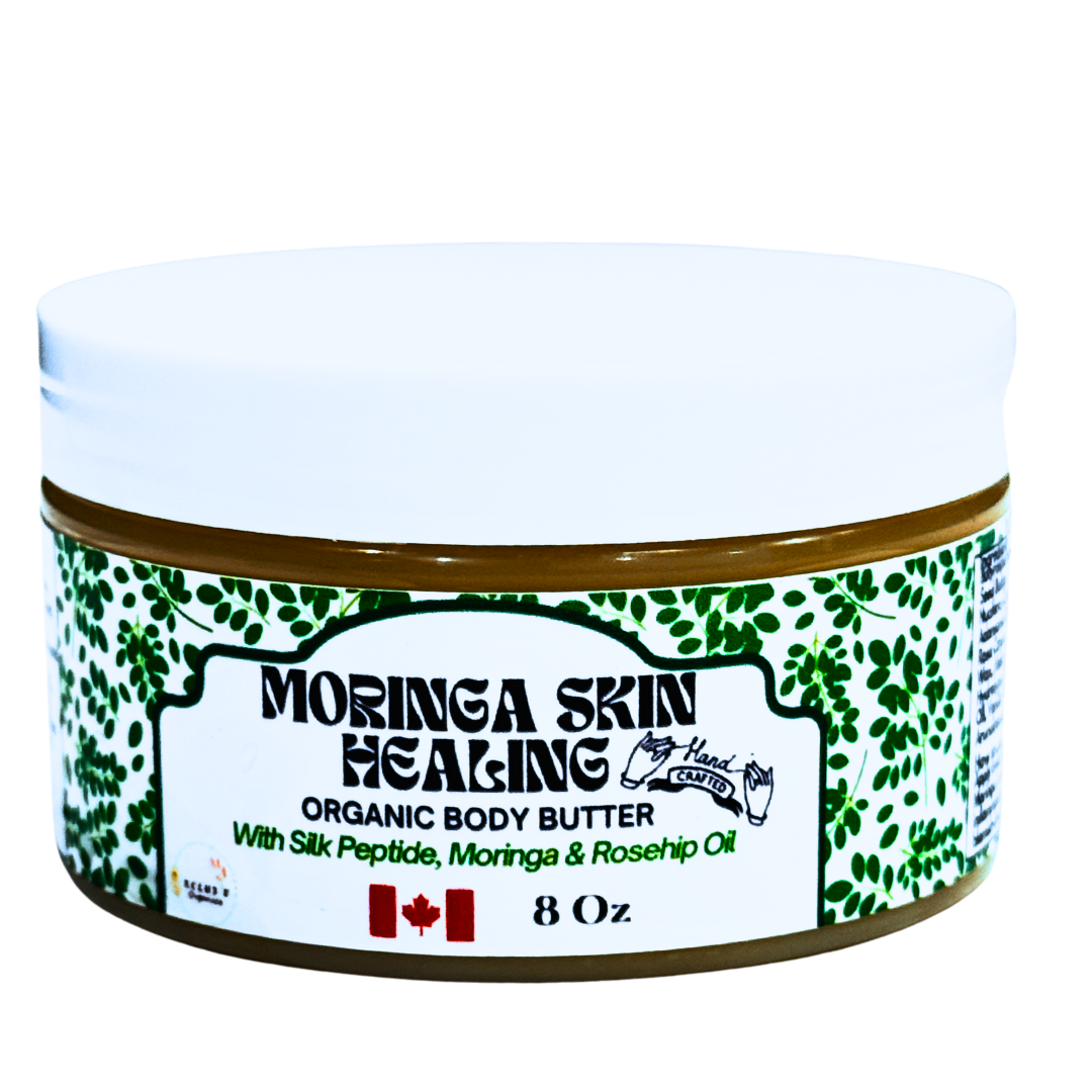 Of Course I Am Moringa Healing Body Butter (Anhydrous) - Soothes Irritation, Heals Problematic Skin, 8 Oz