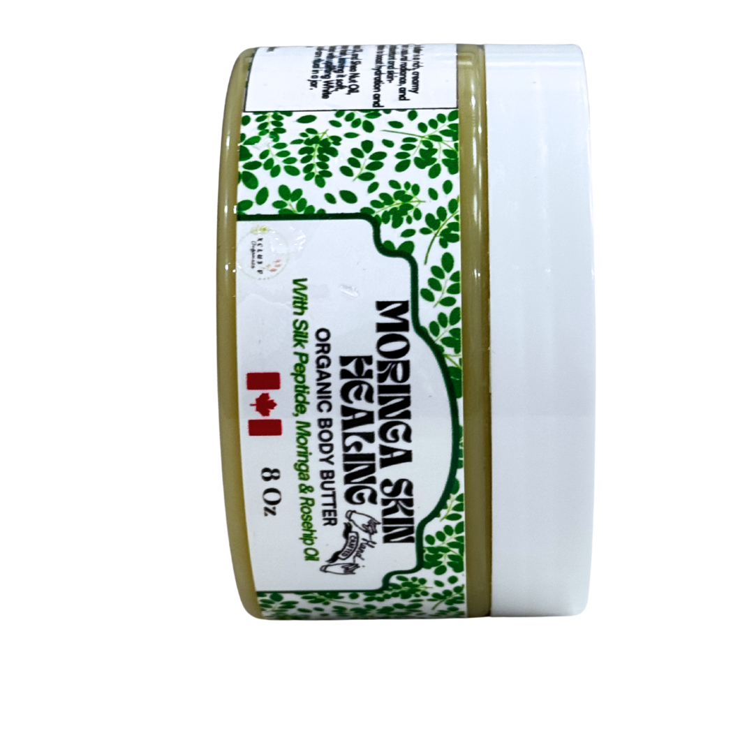 Of Course I Am Moringa Healing Body Butter (Anhydrous) - Soothes Irritation, Heals Problematic Skin, 8 Oz