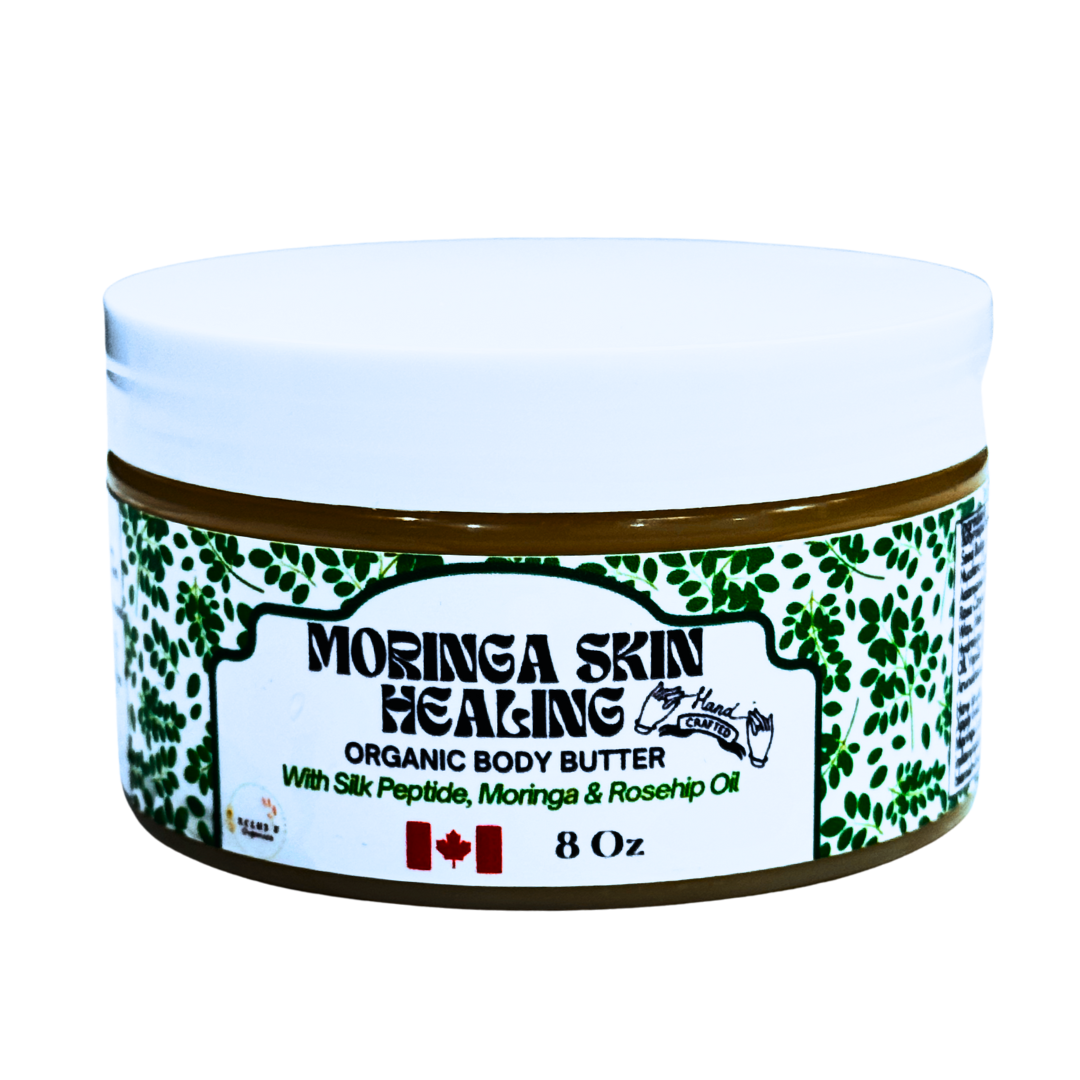 Of Course I Am Moringa Healing Body Butter (Anhydrous) - Soothes Irritation, Heals Problematic Skin, 8 Oz