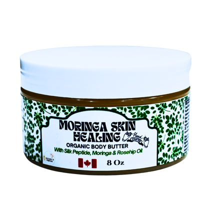 Of Course I Am Moringa Healing Body Butter (Anhydrous) - Soothes Irritation, Heals Problematic Skin, 8 Oz